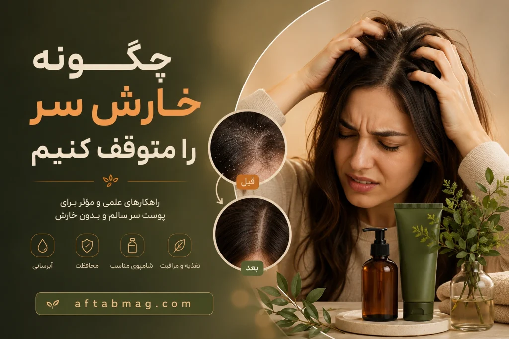 چگونه خارش سر را متوقف کنیم؟ بهترین روش‌های درمان و رفع خارش پوست سر