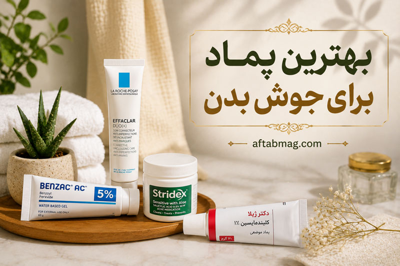 بهترین پماد برای جوش بدن | معرفی گزینه‌های مؤثر برای درمان جوش
